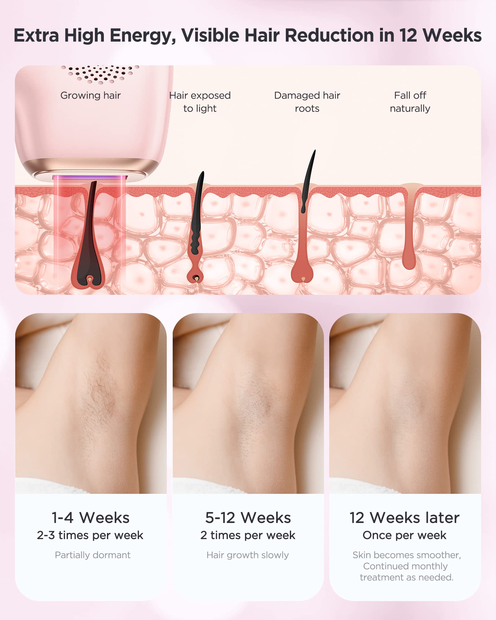 Innza Laser Hair Removal With Ice Cooling Care Function For Women Permanent,999,999 Flashes Painless Ipl Hair Remover, Hair Remo