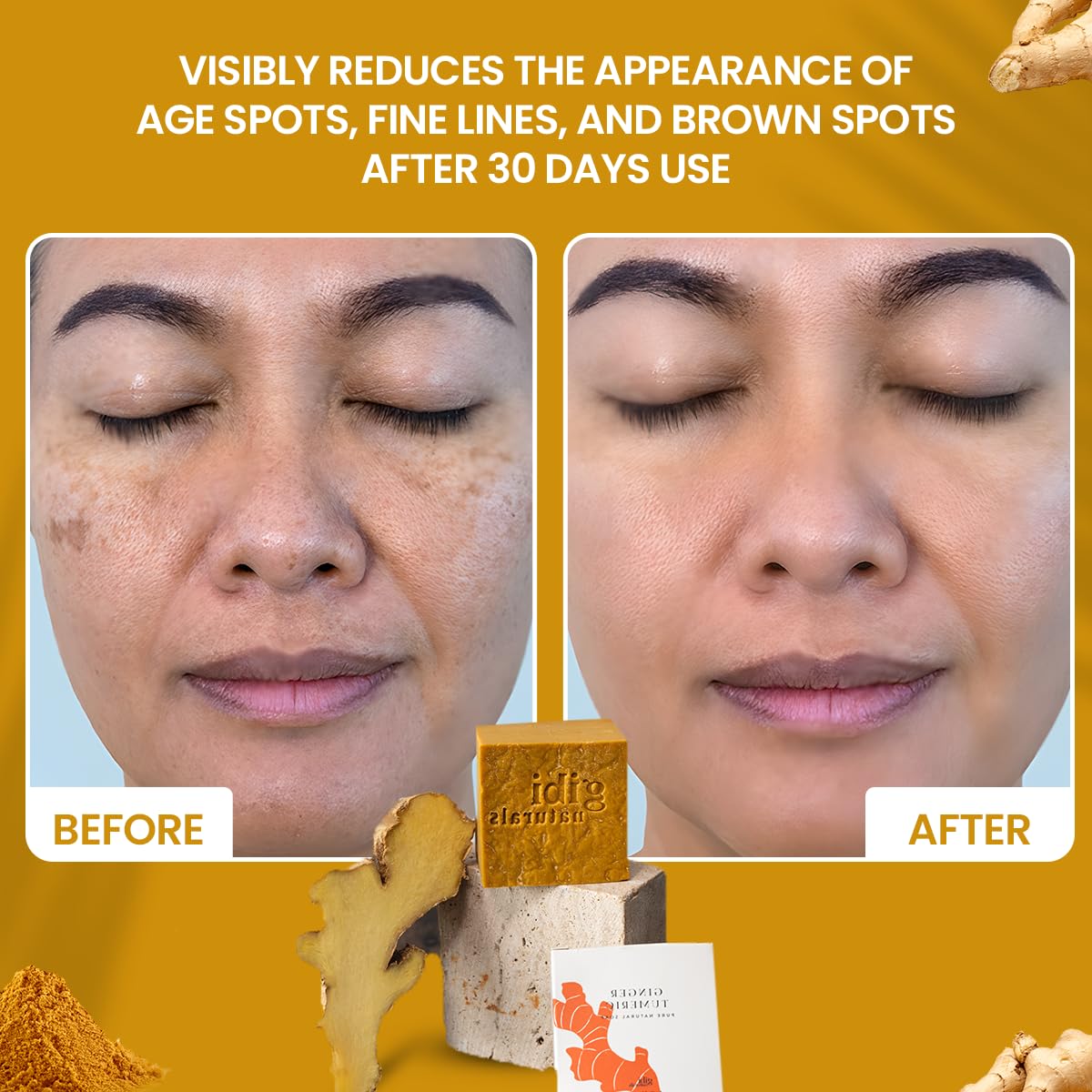 Gibi Turmeric Soap Bar For Acne & Dark Spots - Moisturizing Ginger & Turmeric Soap For Face & Body - Cleanses & Hydrates All Ski