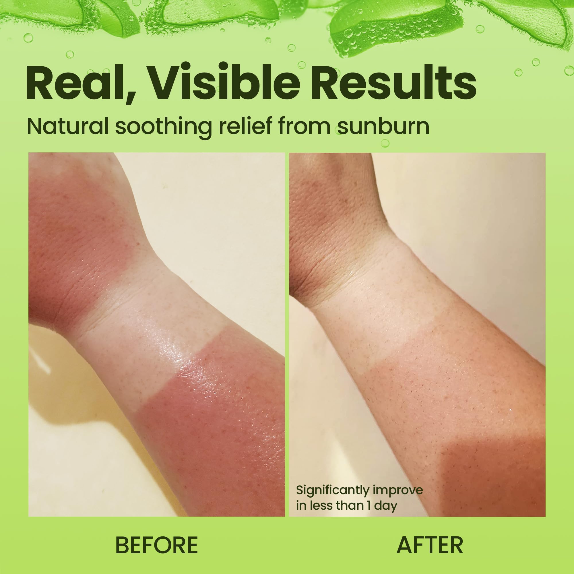 Organic Aloe Vera Gel - 100% Pure For Skin, Sunburn Relief & Face Moisturizer - Extracted From Aloe Vera Plant With Manuka Honey