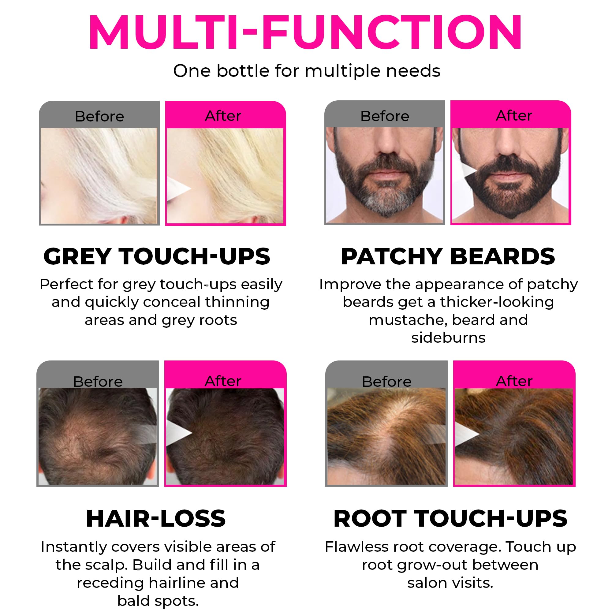 Velo Hairline Powder - Instantly Conceals Hair Loss And Gray Areas, Root Touch Up For Women & Men, Hair Fibers For Thinning Hair
