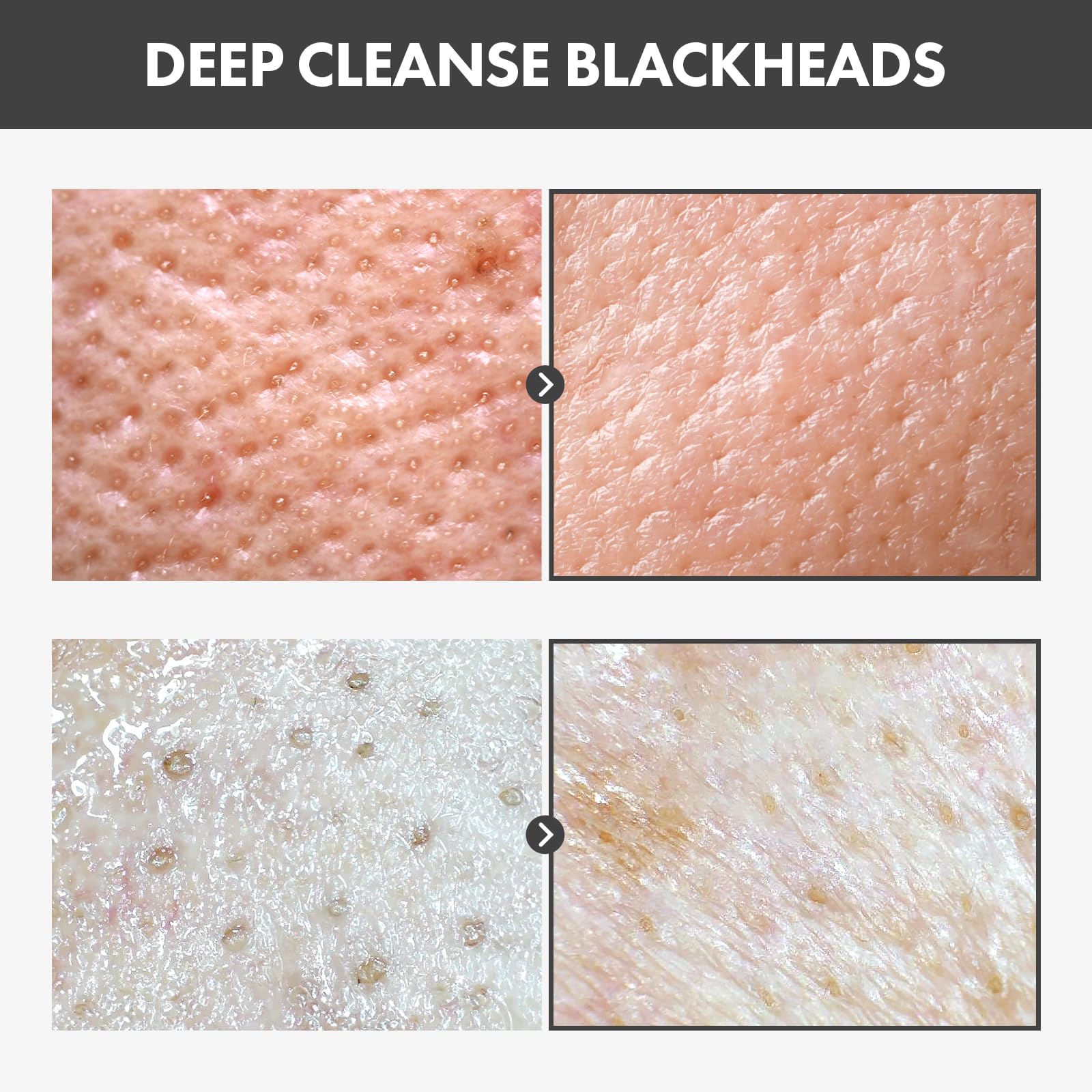Tosowoong Blackhead Peel Off Pack, Charcoal Face Mask Peel Off For Blackheads And Pores, Deep Pore Cleansing, Pore Extractor Exf
