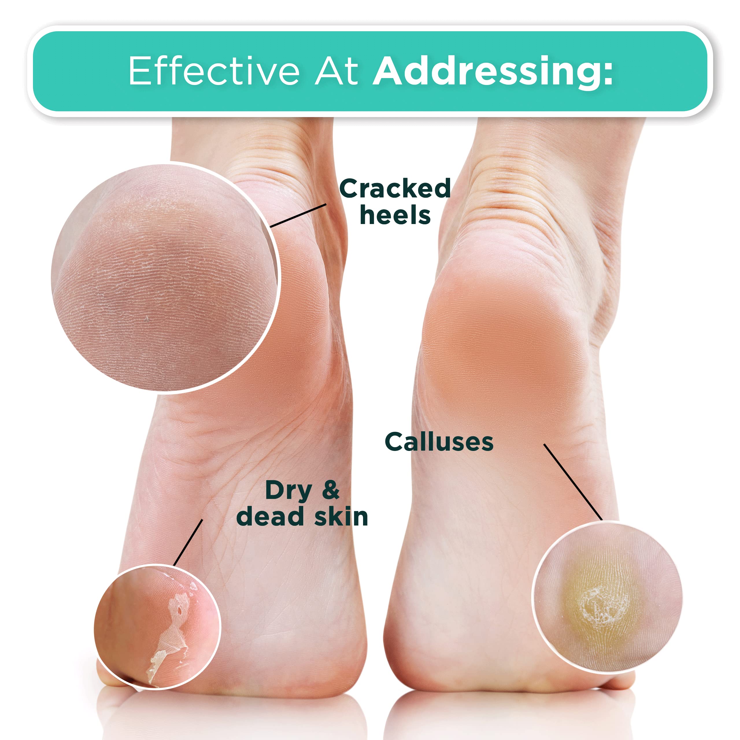 DERMORA Foot Peel Mask - 4 Pack Regular Size Exfoliating Masks for Dry, Cracked Feet - Original Scent, Callus & Dead Skin Remover
