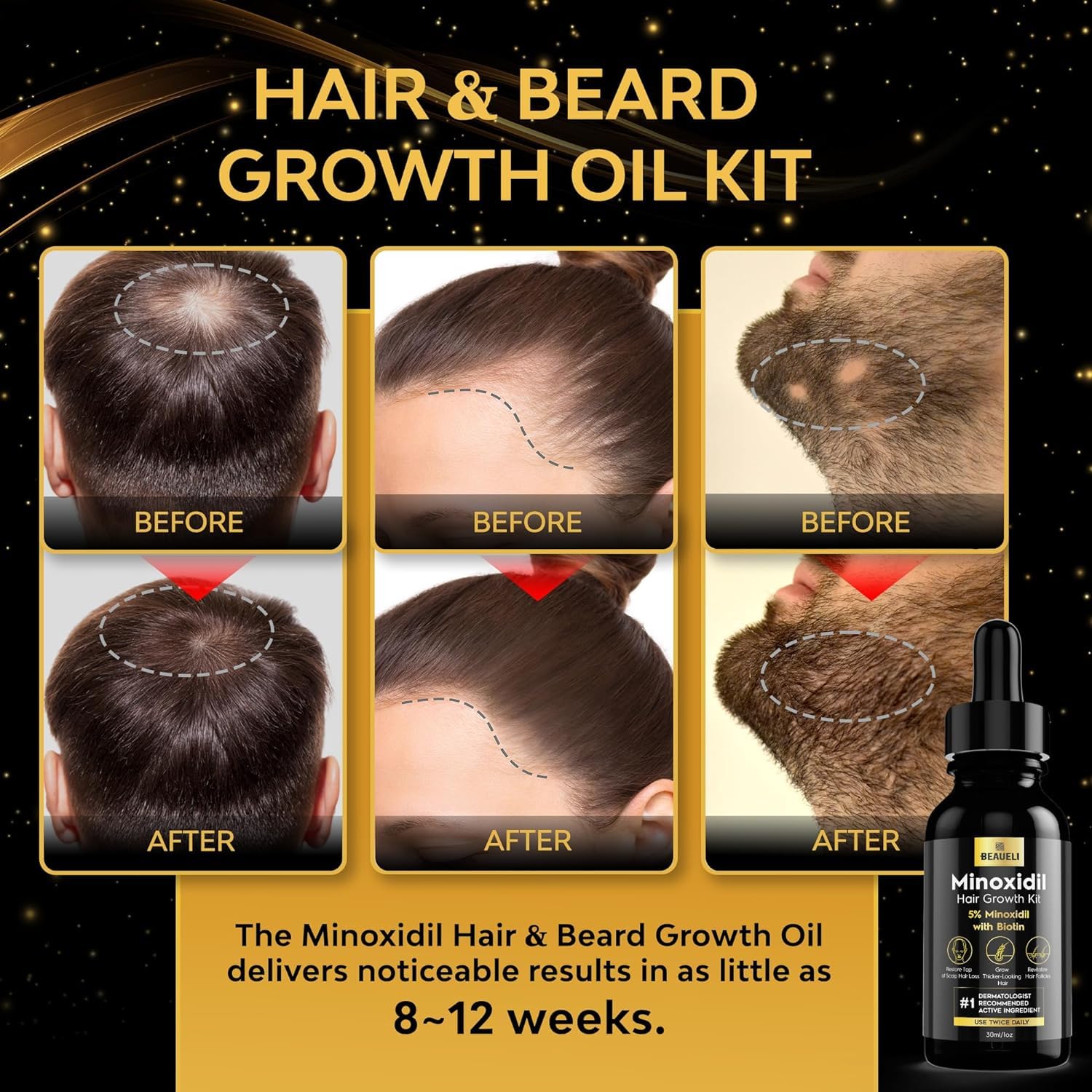 Beaueli 5% Minoxidil For Men And Women, Hair Growth, Beard Growth, Hair Regrowth, Unscented Drop, 3 Fl Oz, 3 Bottles