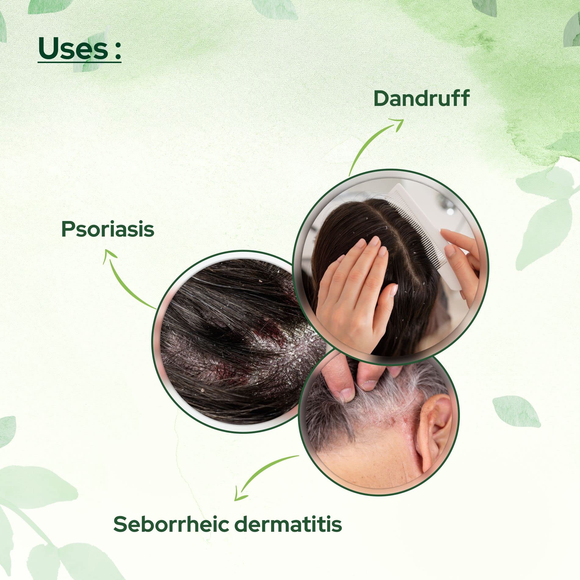 Cosalic Coal Tar And Salicylic Acid Solution/With Salicylic Acid For Dry Scalp Itch Relief Dandruff Free Shampoo/For Psoriasis &