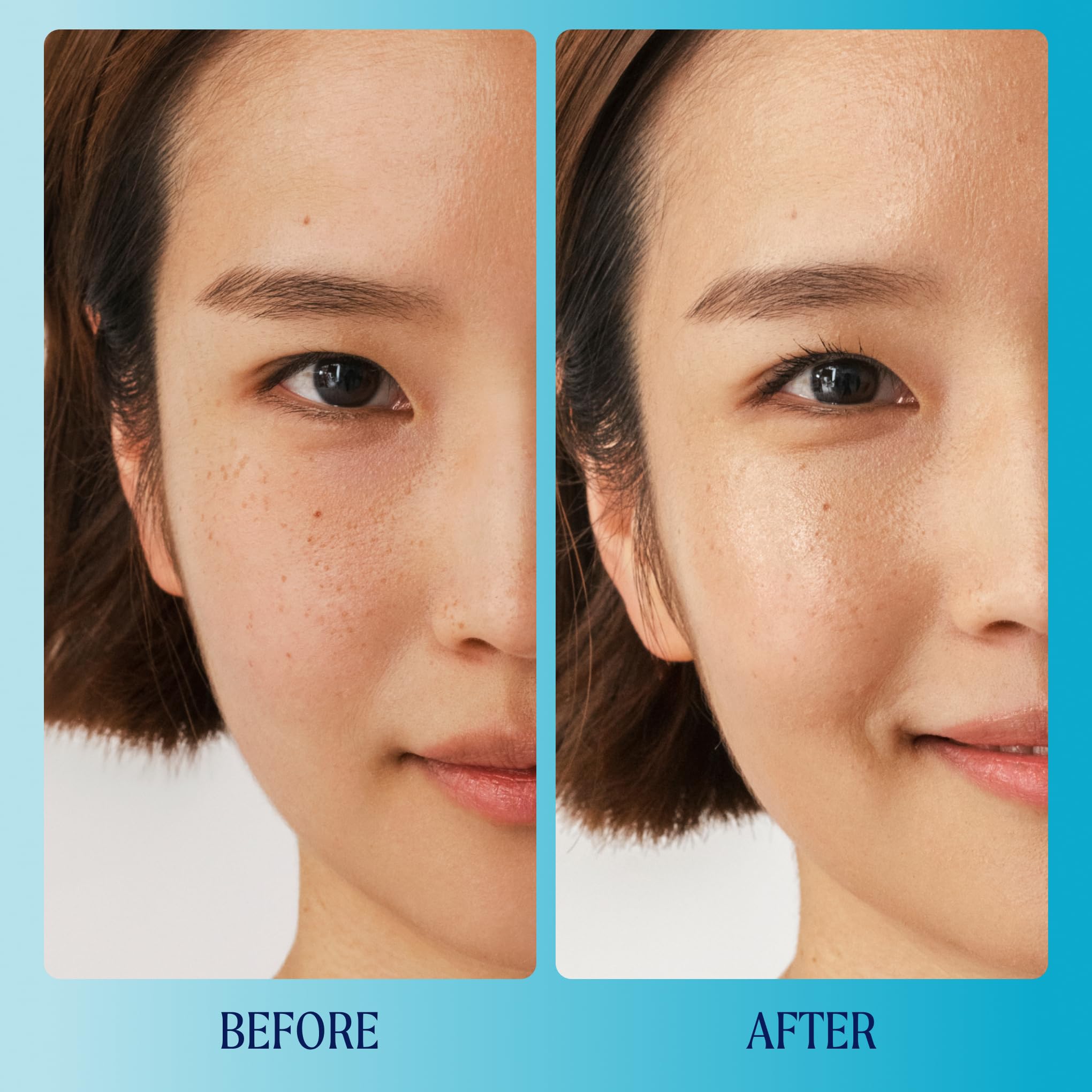 Kinship Supermello Hyaluronic Gel Cream Moisturizer - Hyaluronic Acid Face Lotion - Lightweight + Hydrating - Plump, Smooth + So