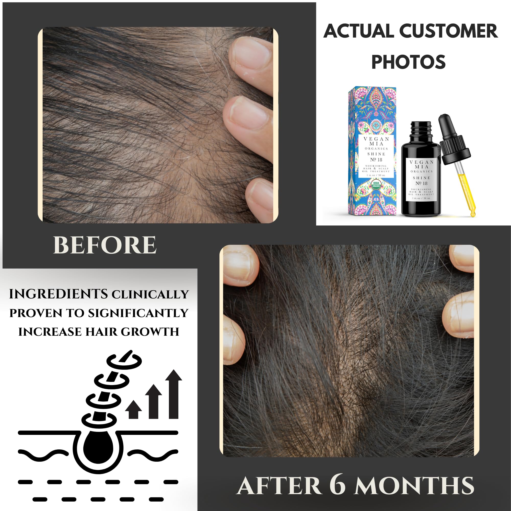 Vegan Mia Usda Organic Rosemary Oil For Hair Growth With Castor Oil & Jojoba Oil - Scalp Treatment & Intense Nourishment To Get