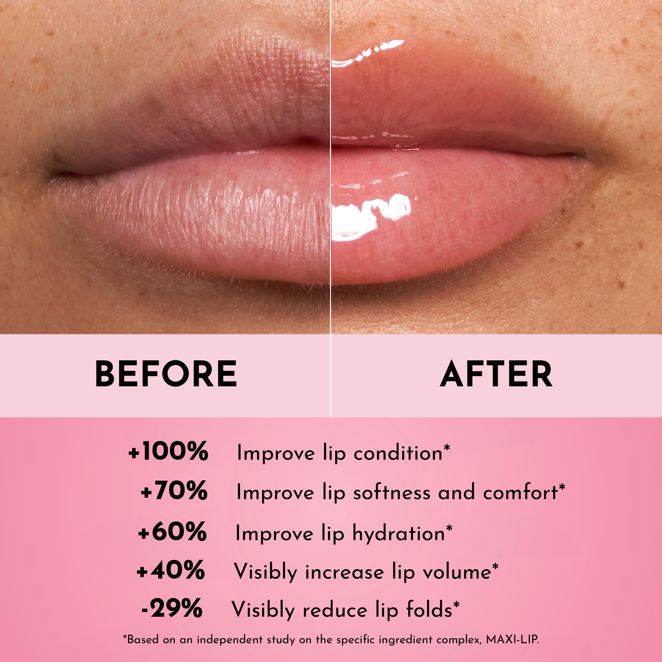 Lawless Forget The Filler Lip Plumping Line Smoothing Gloss - Cherry Vanilla - Premium Volumizing Lip Gloss With Natural Ingredi