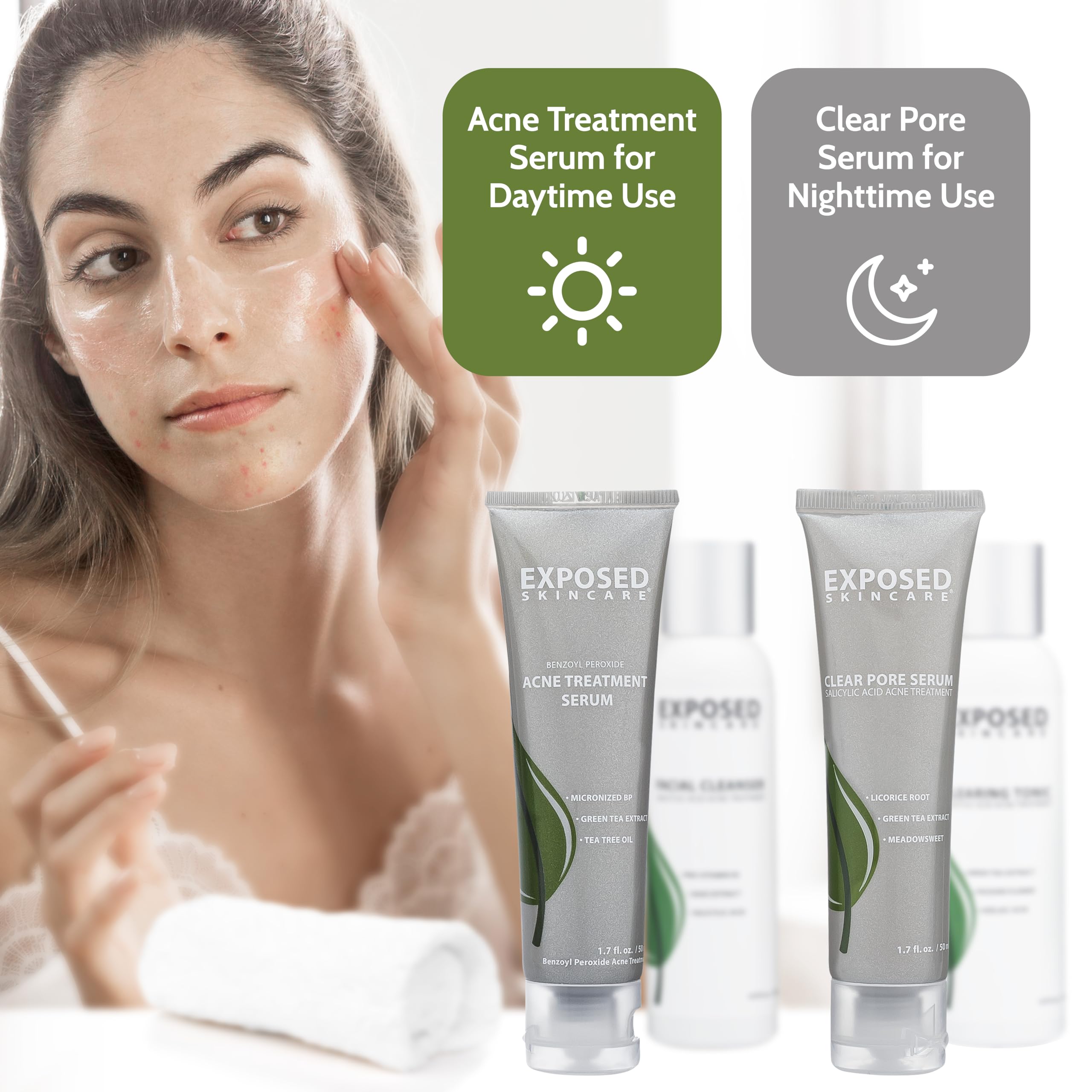 Exposed Skin Care Basic Acne Treatment Kit - Includes Salicylic Acid Face Wash, Clearing Tonic, Treatment Serum With Benzoyl Per