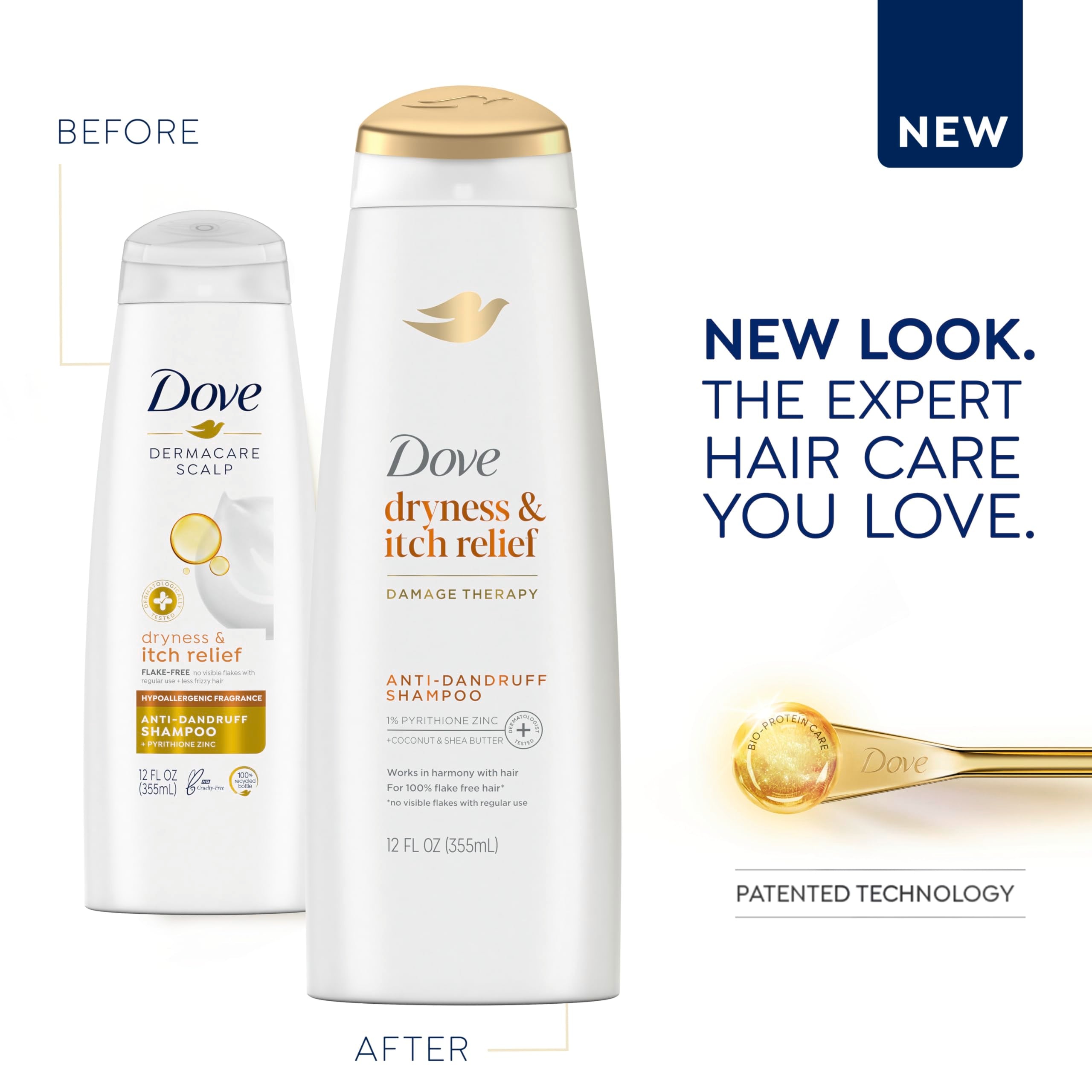 Dove Dermacare Scalp Anti Dandruff Shampoo Dryness And Itch Relief Pack Of 6 For Dry And Itchy Scalp Dry Scalp Treatment With Py