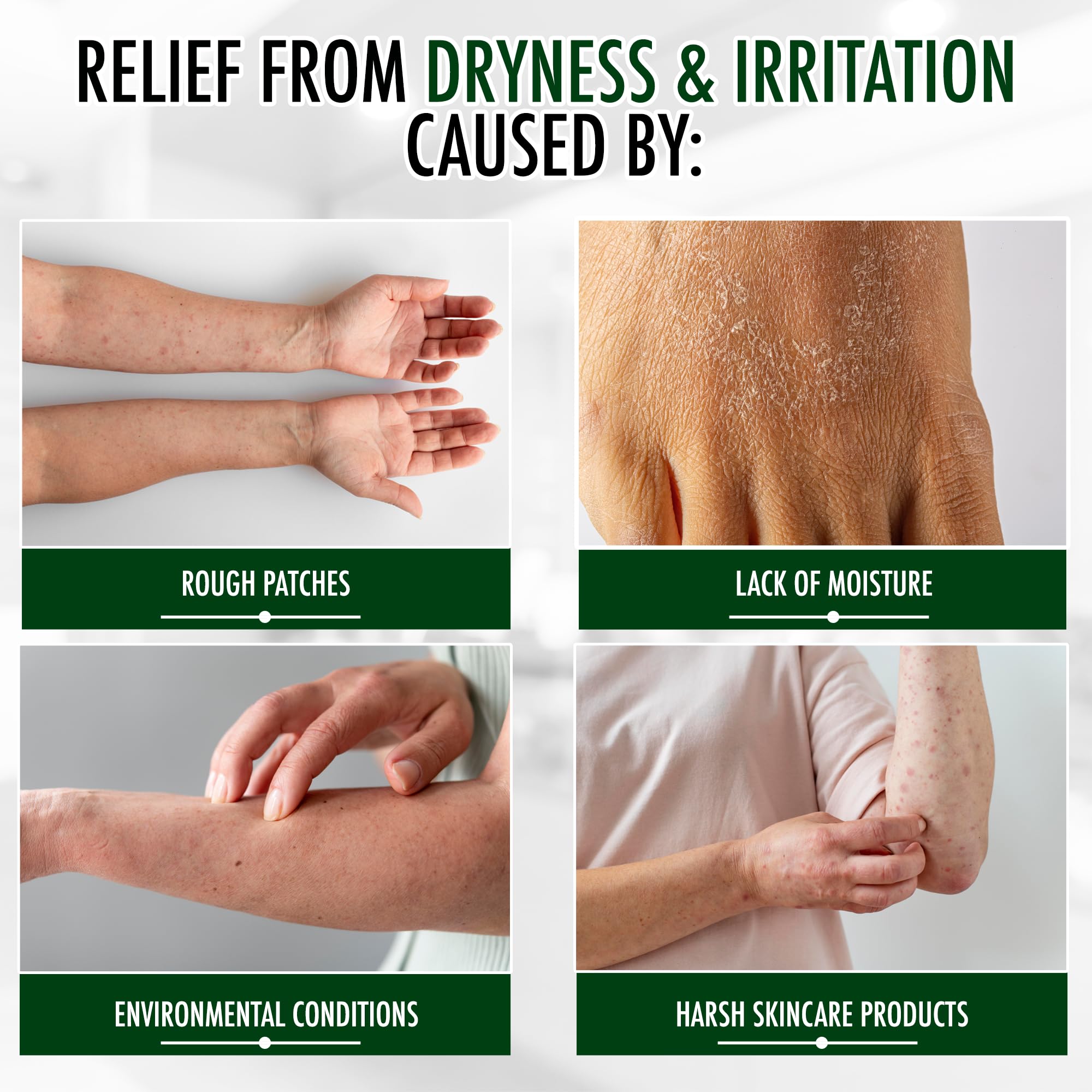 Gly Miracle Moisturizing Body Cream For Extremely Dry Skin, Non- Greasy Skin Humectant For Hands, Body & Feet, Body Lotion For E