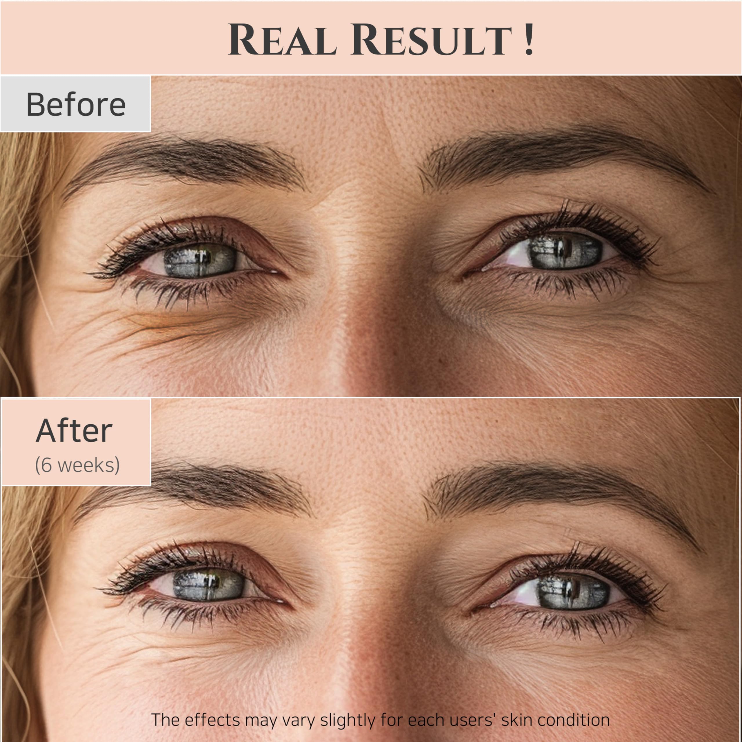 Beauty Of Joseon Revive Eye Serum With Retinal Niacinamide Correction For Puffy Eye Bags Fine Lines Dark Circles Wrinkles, Korea
