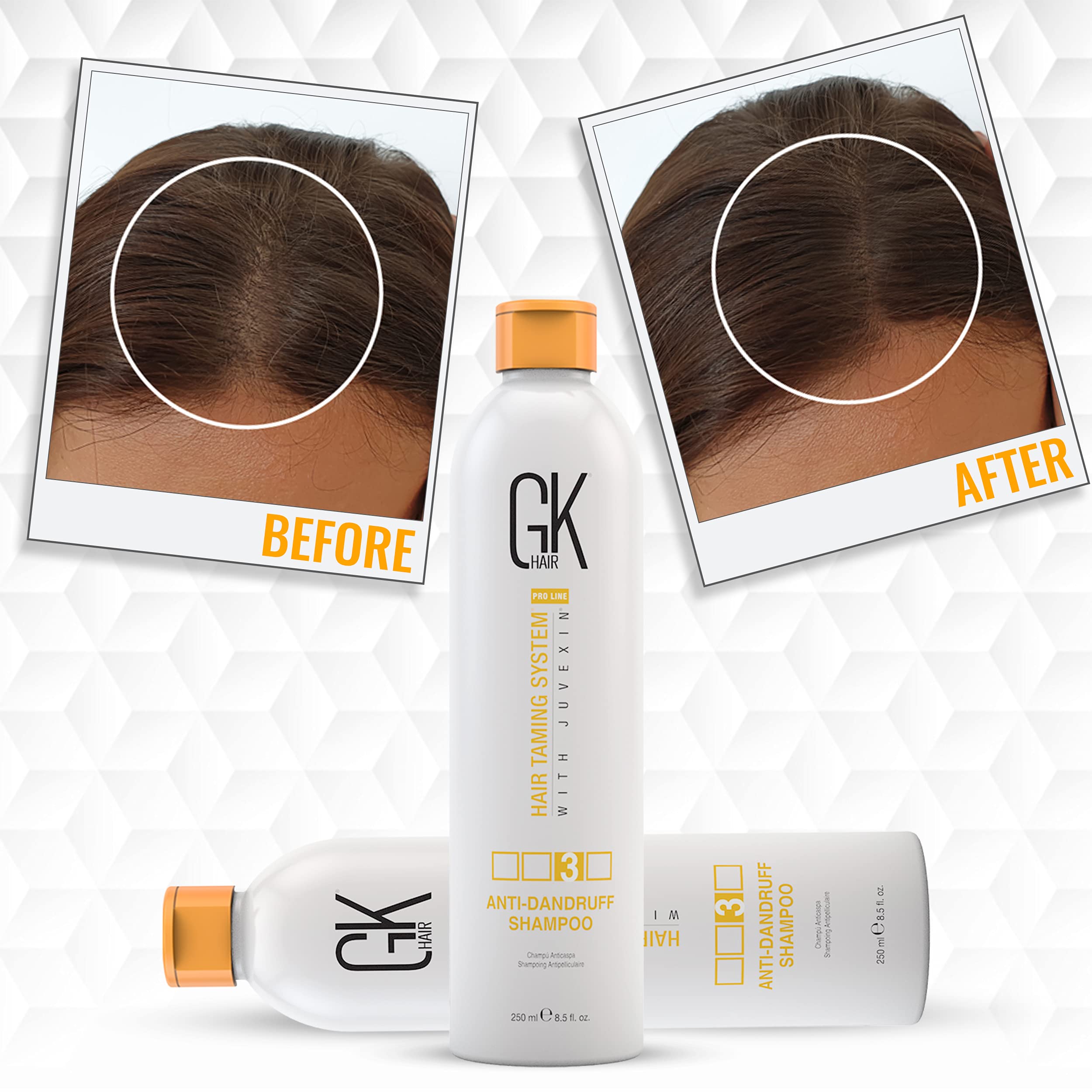 Gk Hair Global Keratin Anti Dandruff Shampoo (8.5 Fl Oz/250Ml) - Hair Deep Cleansing And Impurities Remover Anti Residue Sulfate
