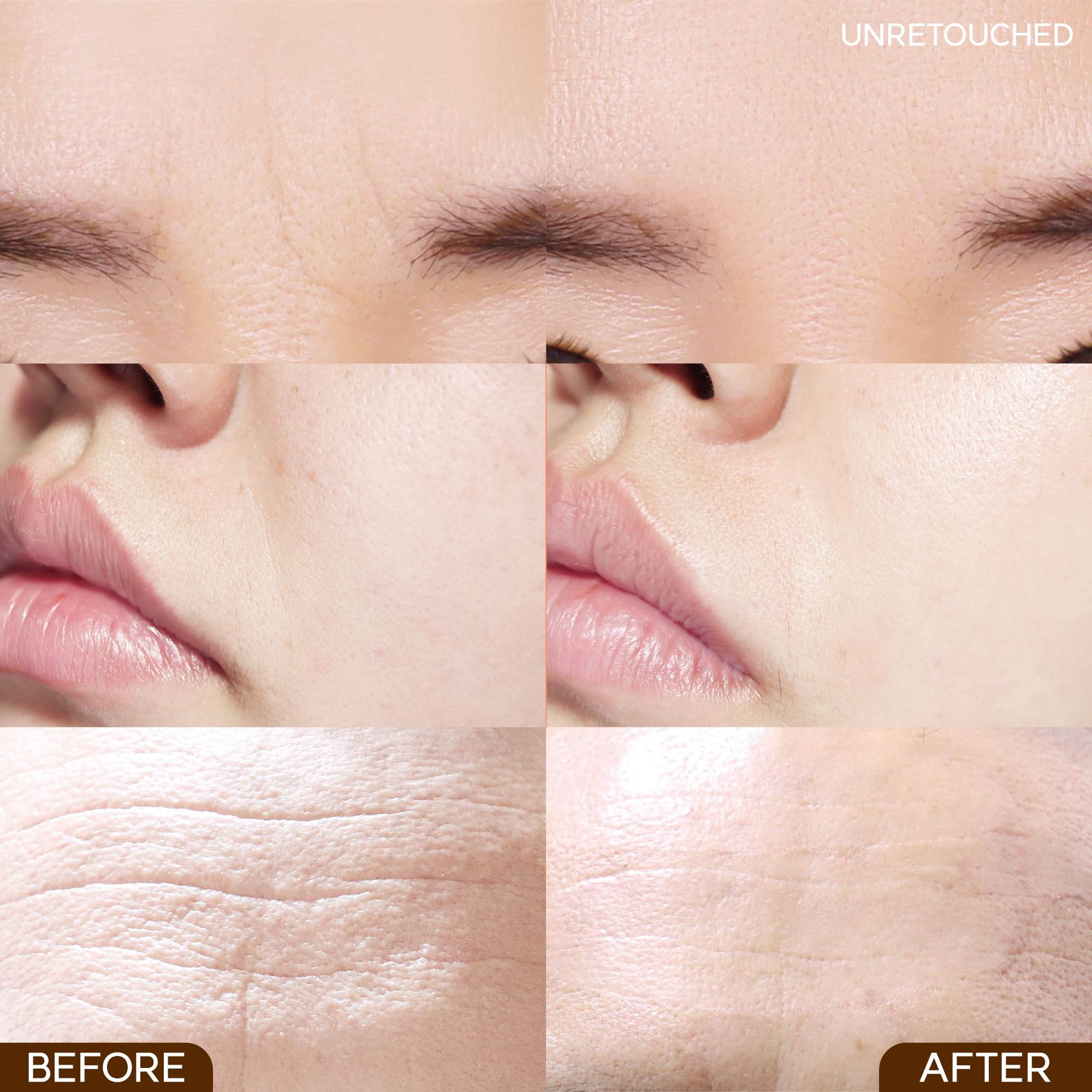 Marshique Wrinkle Repair Patches For Frown Lines Eleven Lines - Between The Eyes Wrinkle Patches Non Invasive Wrinkle Smoothers