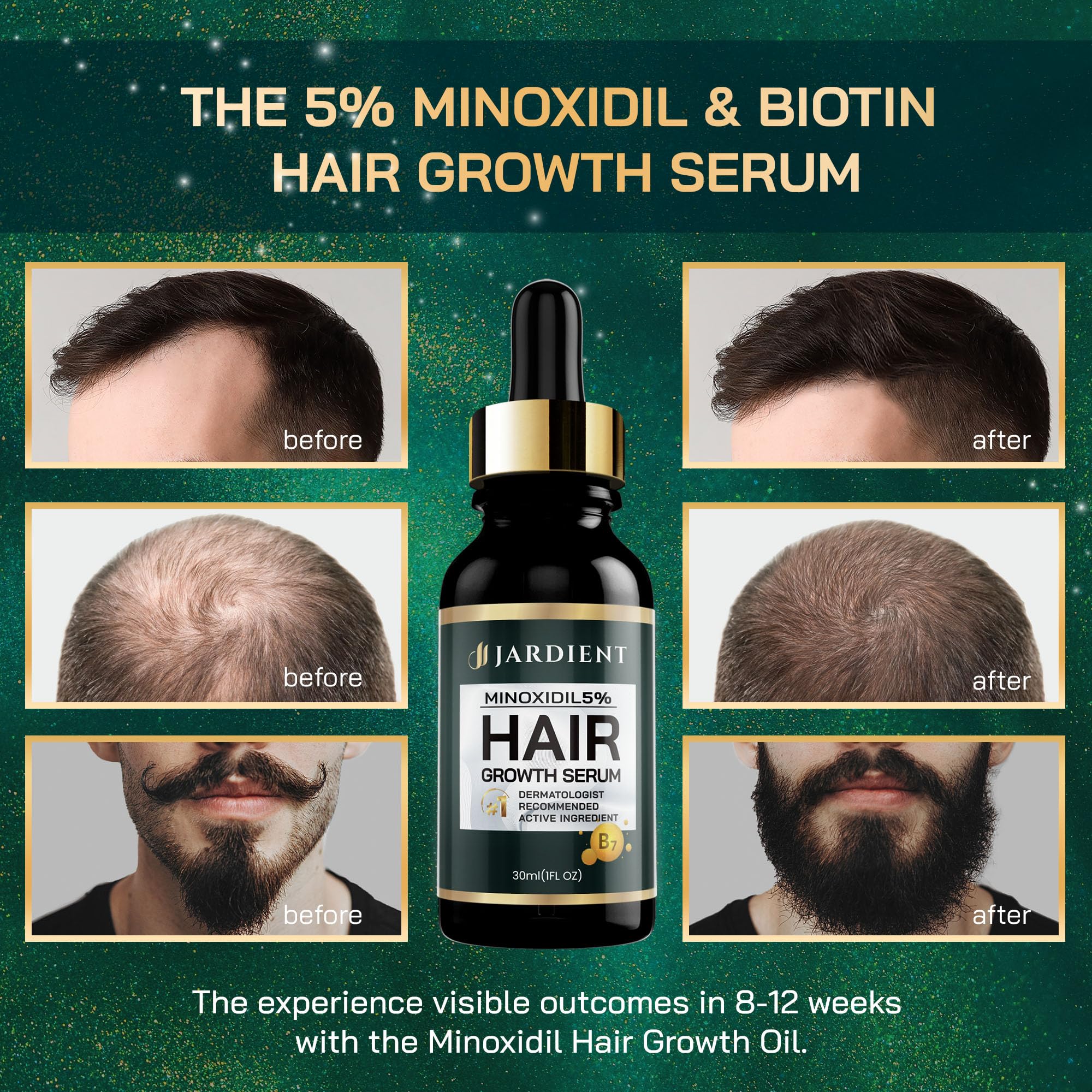 Jardient Minoxidil 5% Serum For Men And Women: Hair Growth Oil With Monoxide, Biotin, Beard Growth Kit - Minoxidil Serum - 1 Fl